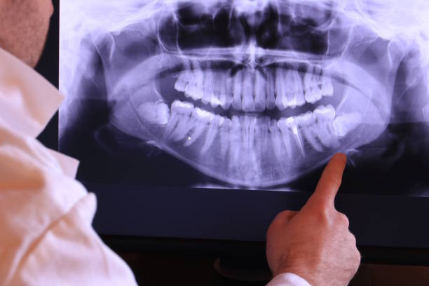 Best Emergency Dental Care for Sports Injuries in Morton, WA