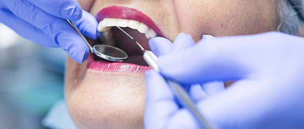 Best Emergency Root Canal Therapy in Morton, WA
